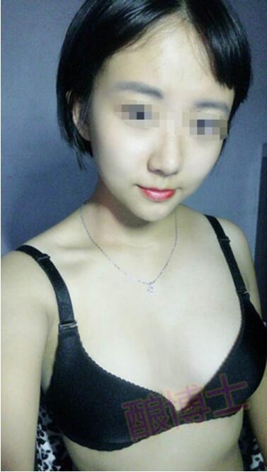 酿博士丰胸产品怎么样 真人体验酿博士酒酿蛋的效果