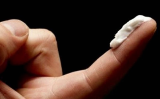 股沟癣很尴尬  专家支招教您摆脱折磨。