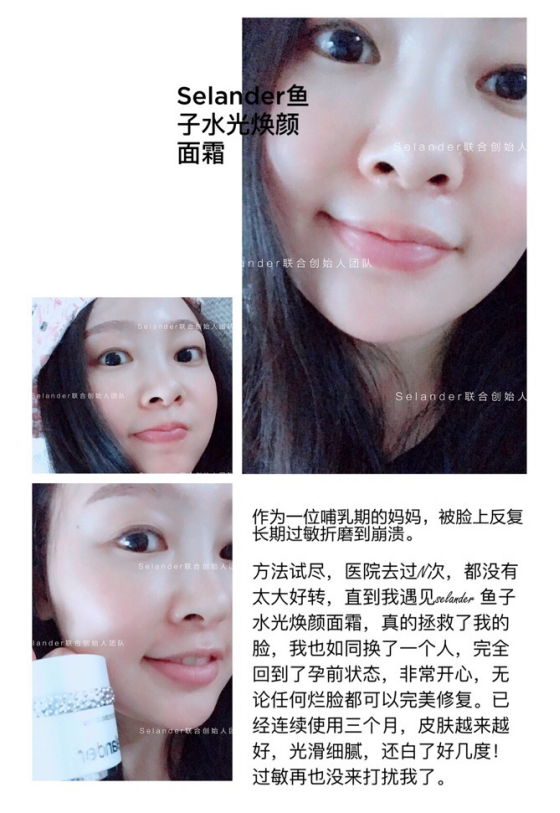 护肤品中的Selander鱼子面霜 功效到底如何