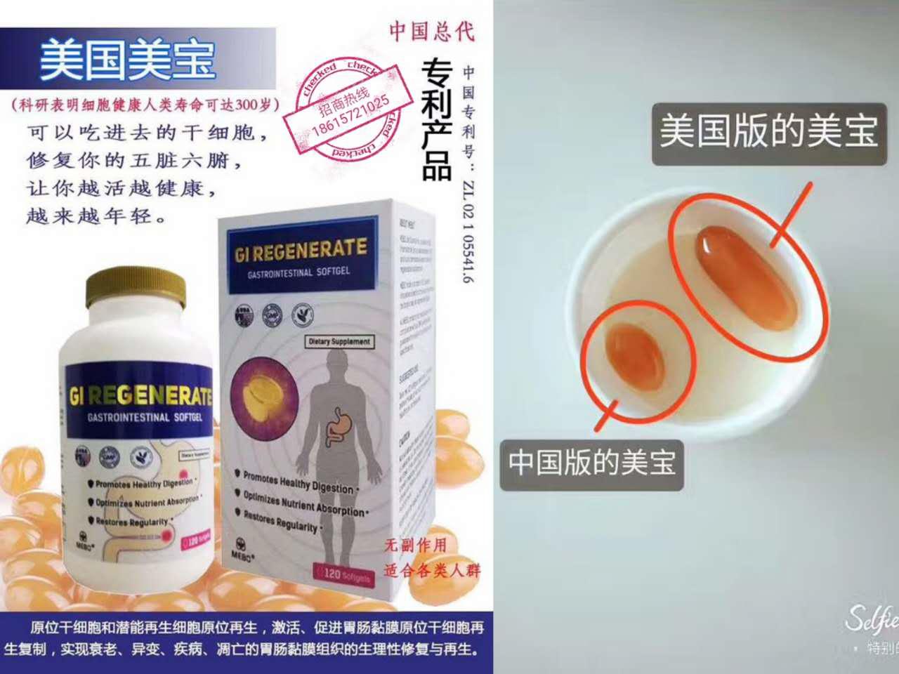 美国进口美宝牌胃肠胶囊效果怎么样？