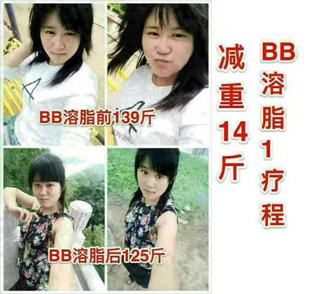 BB溶脂减肥药有没有副作用？一粒瘦2-6斤真的吗？会不会反弹？一粒见效真的吗？