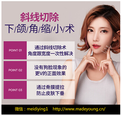 下巴形状修复！美迪莹告诉你韩国下颌角修复手术的秘密！