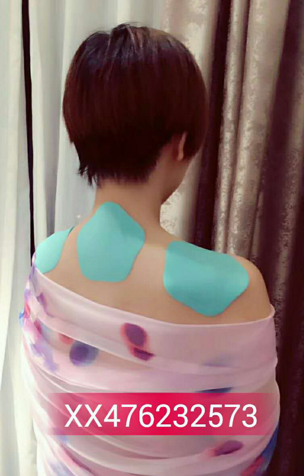 什么是富贵包，怎么彻底消除，活力舒理敷贴消除富贵包是什么原理