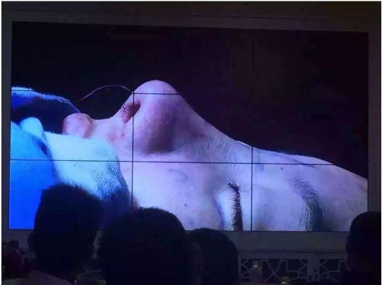 合肥韩美汇聚多位专家举办鼻整形学术研讨会