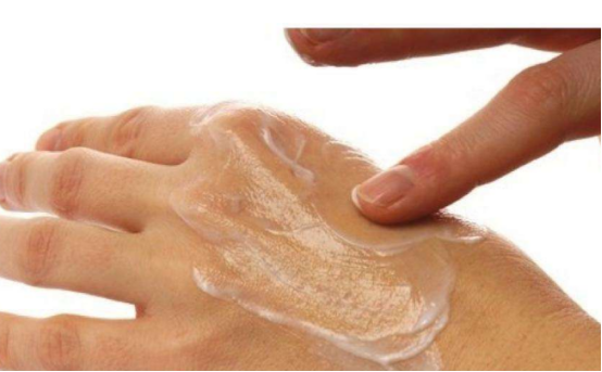 手掌长湿疹怎么办？抹抹这个分分钟搞定湿疹