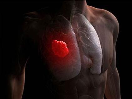 知名三甲医院医生在线直播，肺癌帮邀您聆听权威医生现场解答