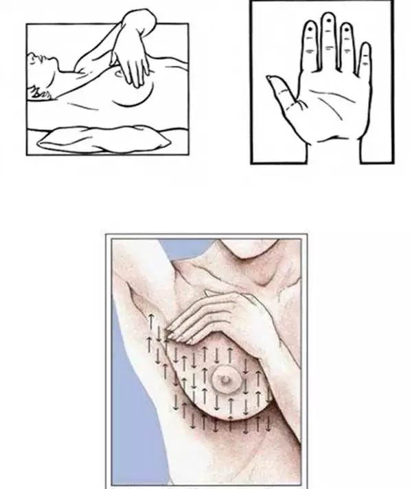 春雨国际解读：早癌筛查要不要做？该如何做？