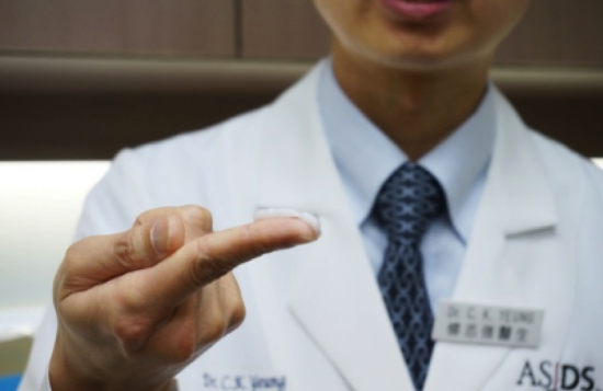 铜钱癣的治疗方法，避免陷入这三个误区