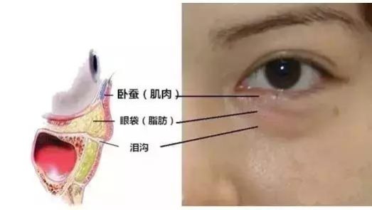 爱德丽格刘志刚小讲堂（8）：卧蚕、眼袋和泪沟傻傻分不清？