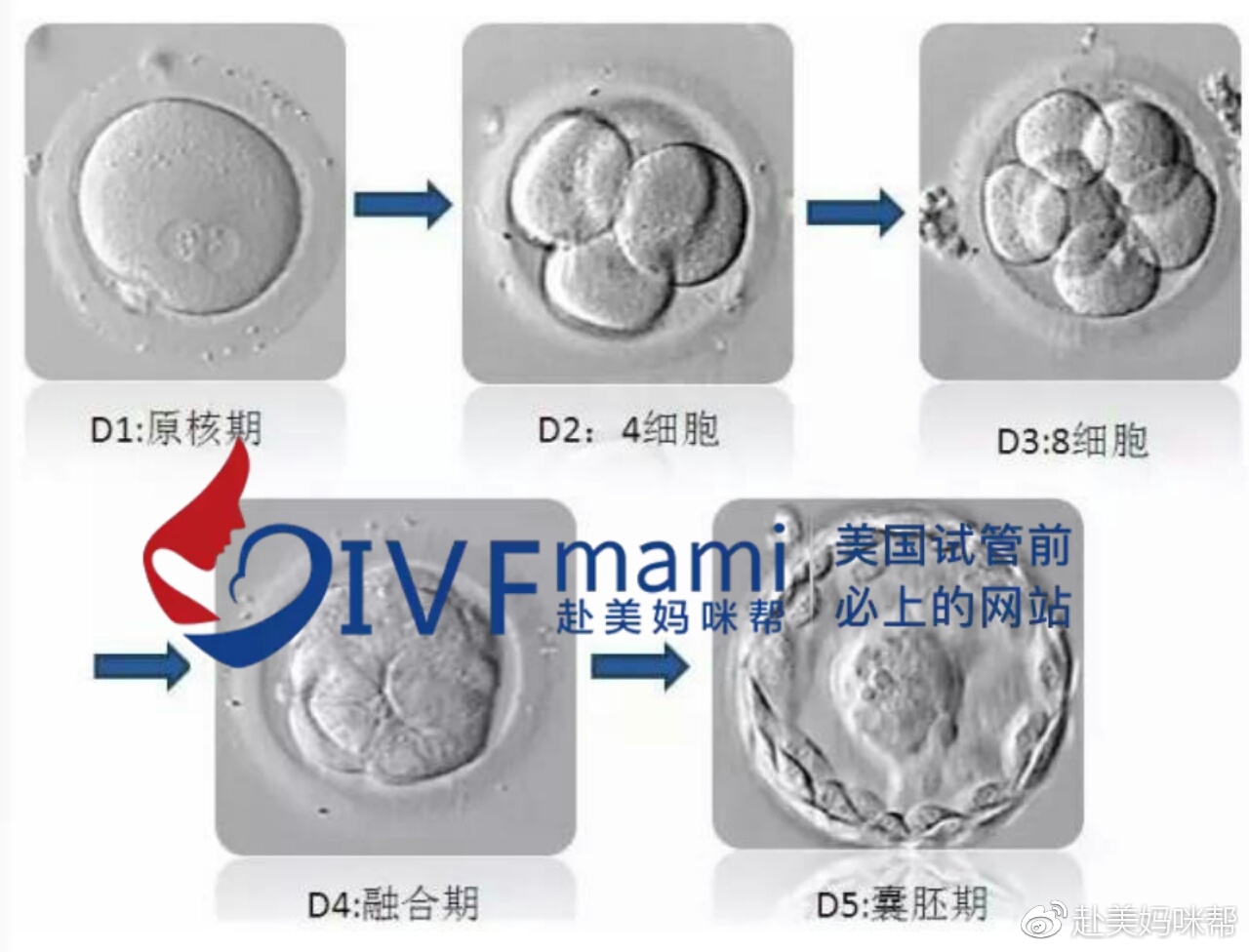 赴美妈咪帮：5AA？811？美国试管婴儿胚胎等级知多少？