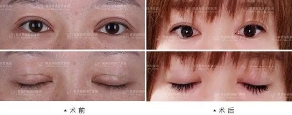 3.webp.jpg 3.webp.jpg