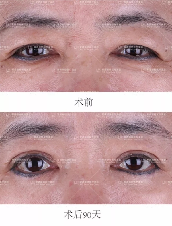 2.webp.jpg 2.webp.jpg