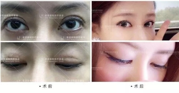 4.webp.jpg 4.webp.jpg