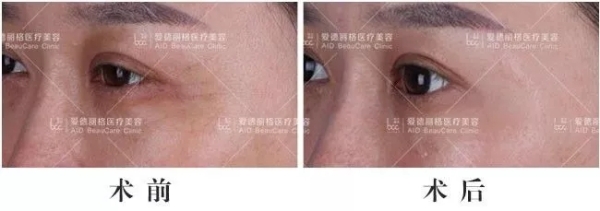 5.webp.jpg 5.webp.jpg