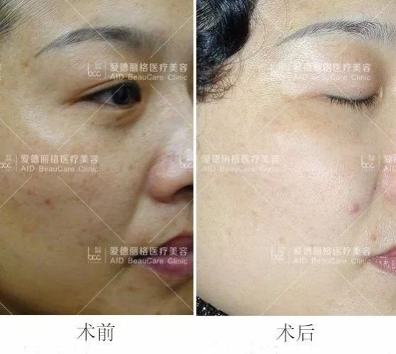 7.webp.jpg 7.webp.jpg