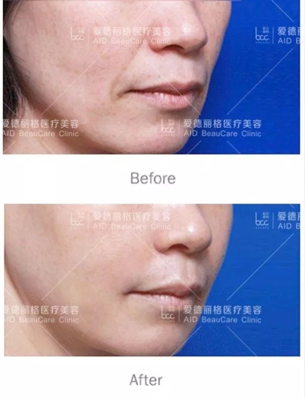 6.webp.jpg 6.webp.jpg