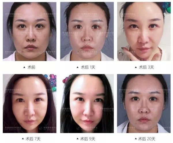 8.webp.jpg 8.webp.jpg