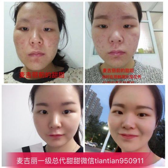 麦吉丽一级总代甜甜带你轻松月入过万，想做代理的不要错过啦！！！