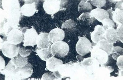 是病菌无孔不入吗？同一部门6人中枪“幽门螺杆菌”的背后